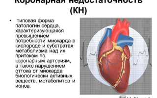 Острая коронарная смерть причины, неотложная помощь и прогноз