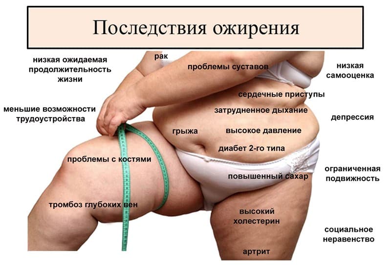 ожирение и образ жизни