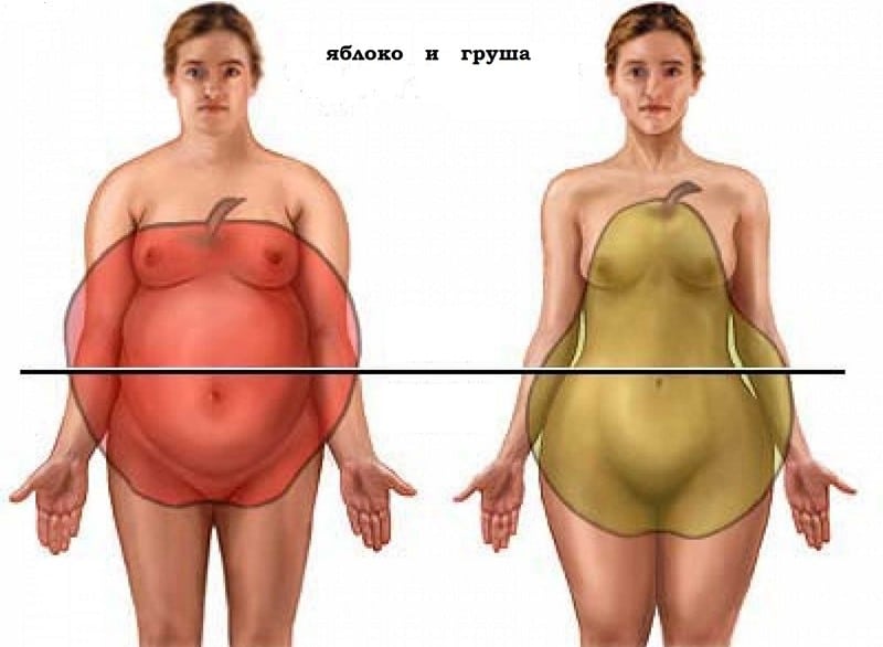 три типа ожирения