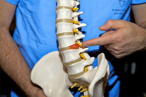 Вовремя выявленная грыжа позвоночника имеет больше шансов на лечение