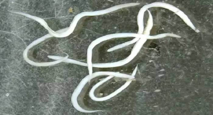 острицы у детей