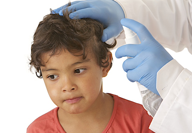 лечение Педикулеза