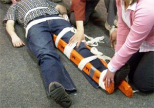 Фиксация при переломе бедренной кости Иммобилизация бедра