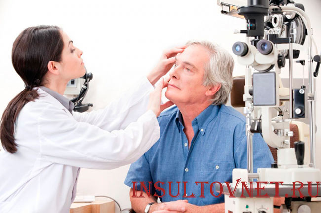 Окулист после инсульта