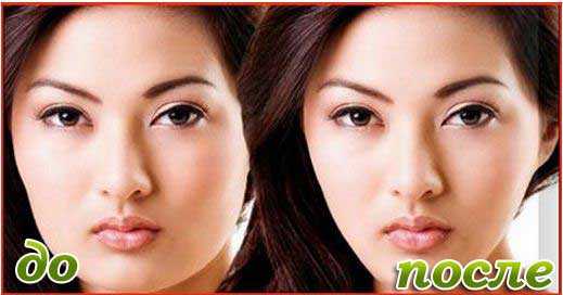 Похудение в лице Похудение в лице