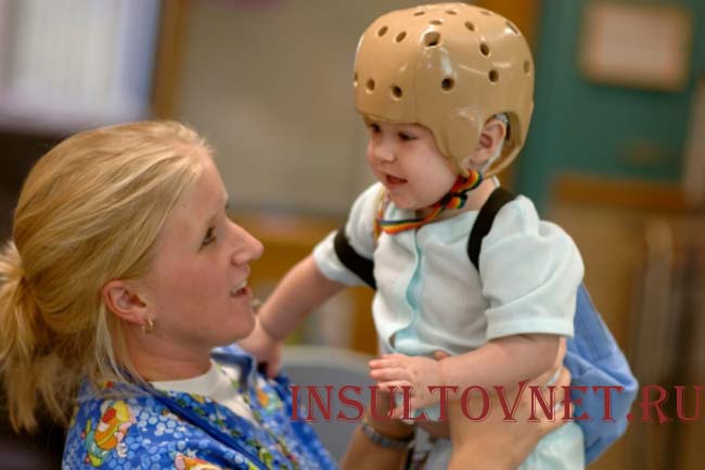 Эпилепсия у детей