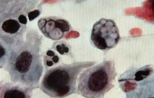 Суть проблемы хламидии