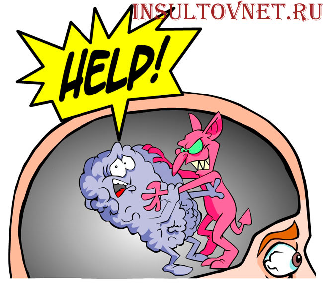 повторный инсульт