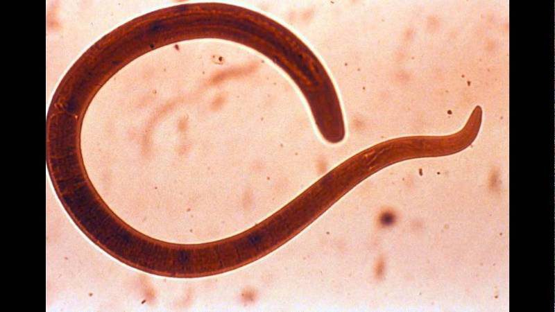 Трихинеллы