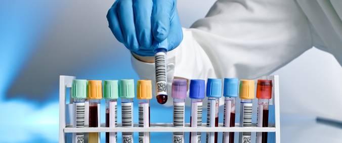 диагностика бычьего цепня