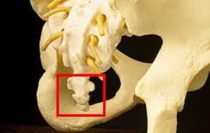 Копчик Перелом копчика встречается в основном у маленьких детей или у пожилых людей