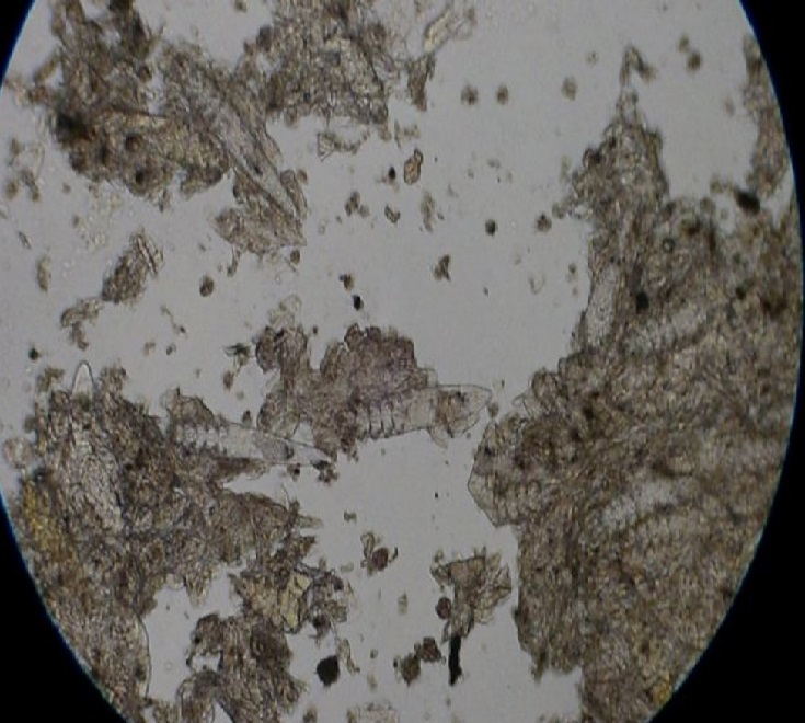 Вид яйцеглистов под микроскопом