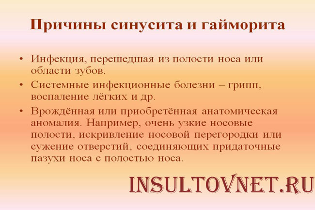 Причины гайморита