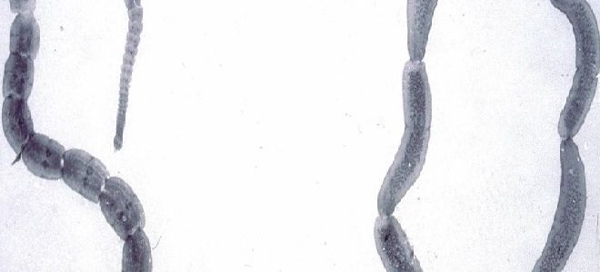 Огуречный цепень у человека