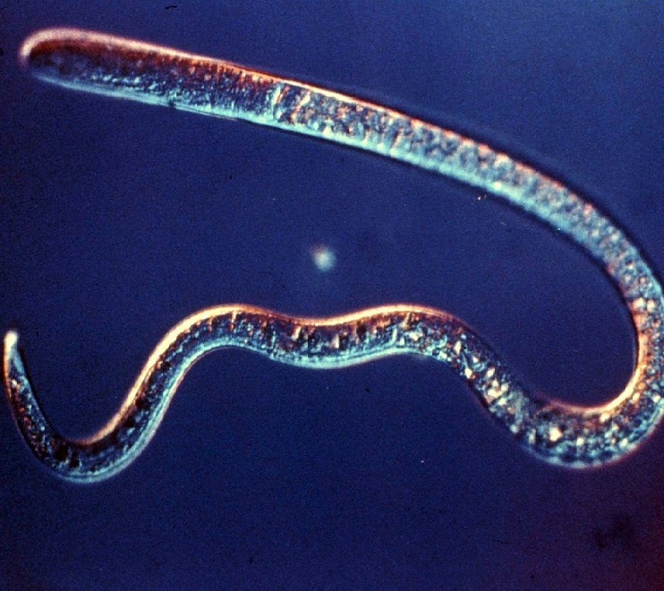 Паразиты, живущие в легких человека