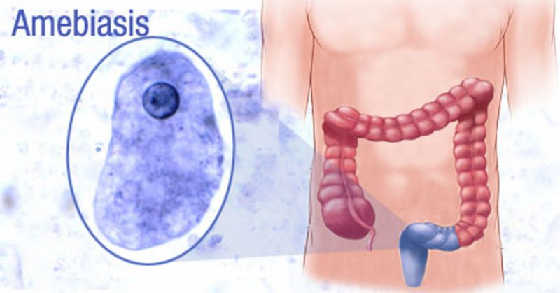 человек подвержен амебиазу