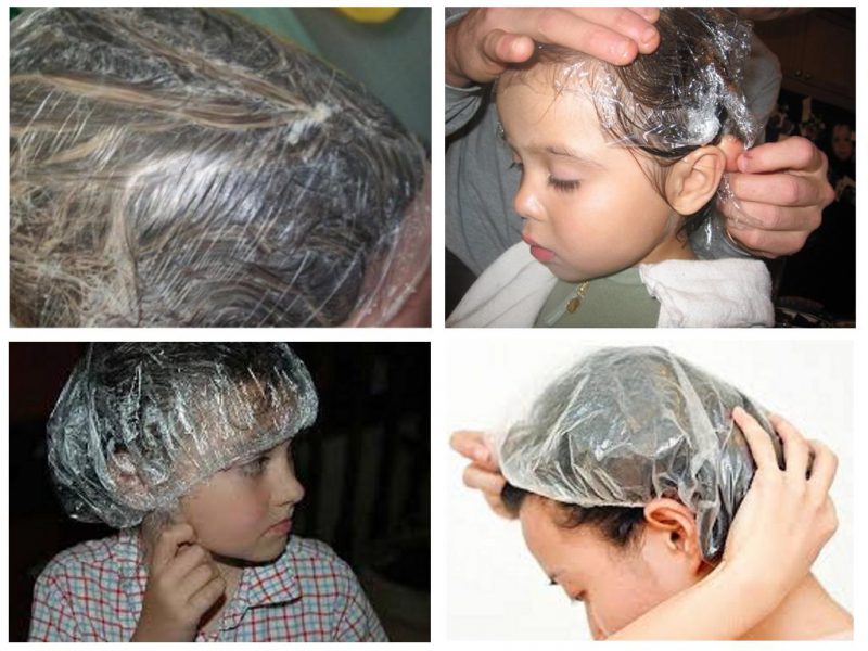 как избавиться от вшей