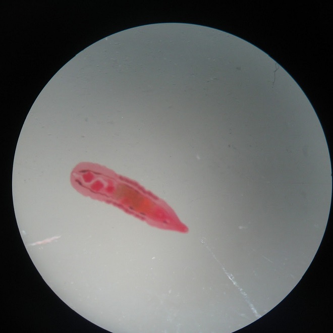 Opisthorchisfelineus - возбудитель описторхоза