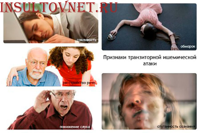 признаки ТИА