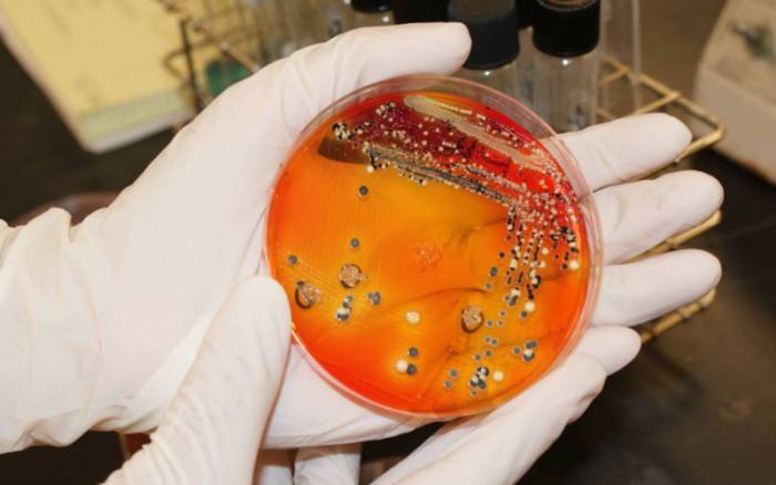 сальмонеллез