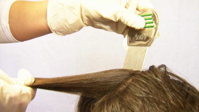 вычесывание вшей гребнем