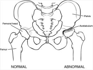 Картина заболевания Нормальный и поврежденный сустав