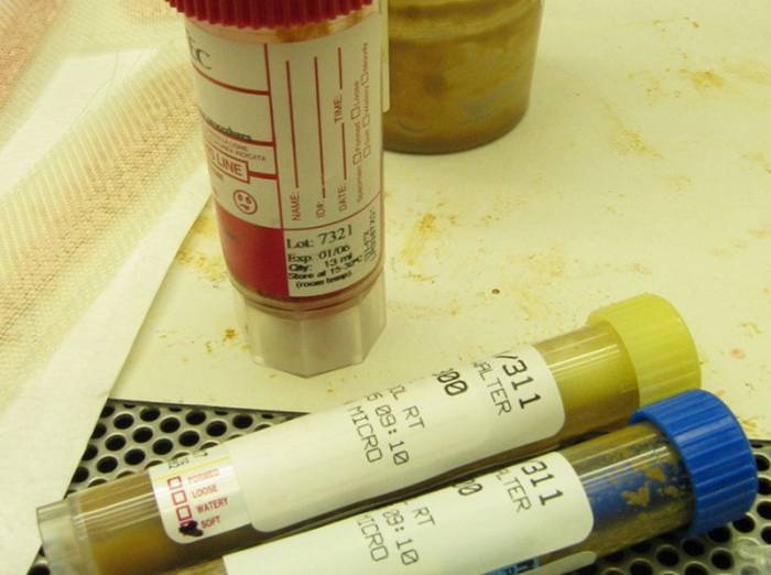 анализ кала