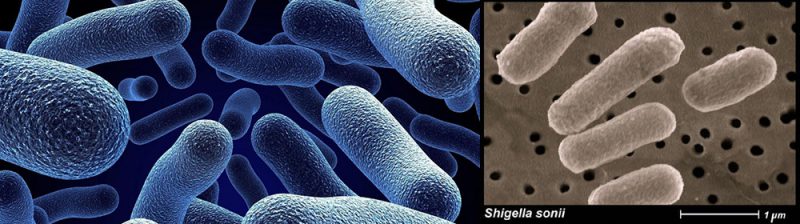 шигинелла зоне