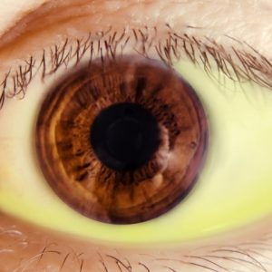 Осложнения и последствия синдрома Жильбера