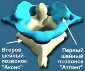Строение шейных позвонков Аксис и Атлант