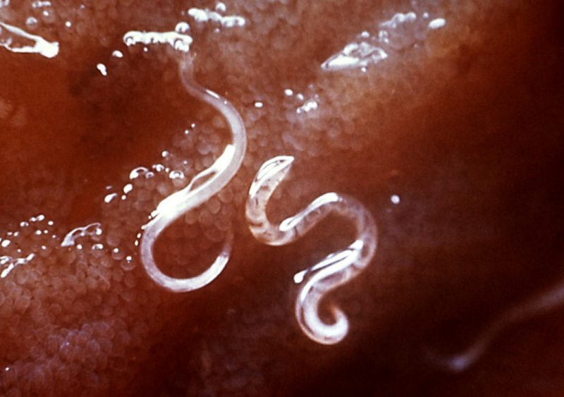 гельминты внутри человека