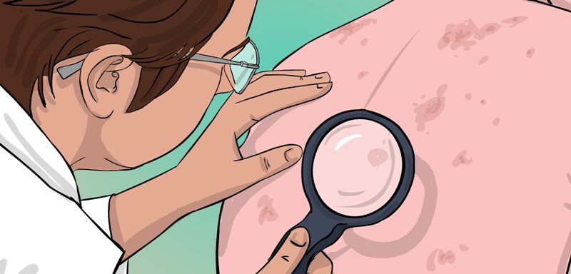 врач осматривает кожу