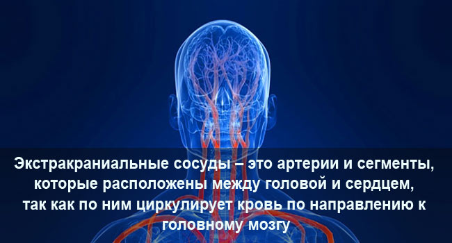 Экстракраниальные сосуды головного мозга