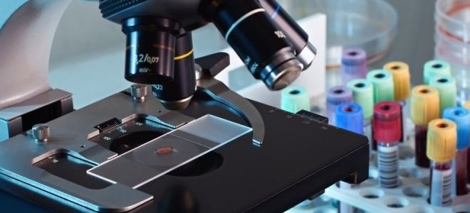 Анализ крови на определение глистов