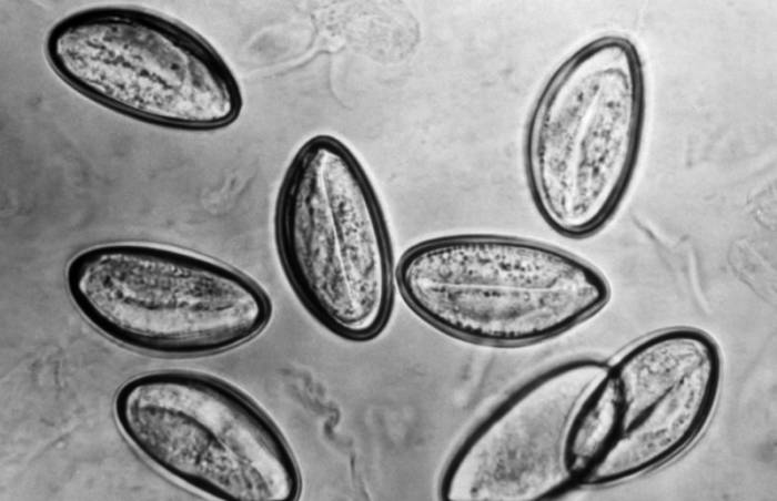 Энтеробиоз