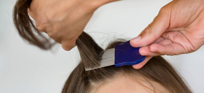 вши у ребенка