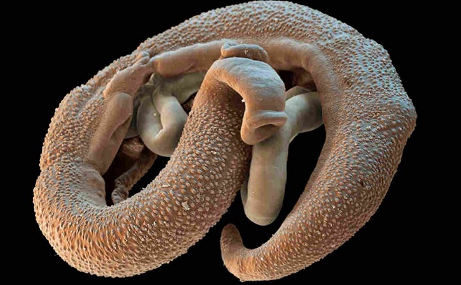 Шистосомы - опасный паразит для человека