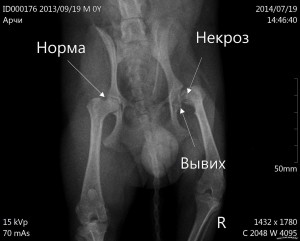 Диагностика головки бедренной кости Синнонимы: асептический некроз головки бедренной кости