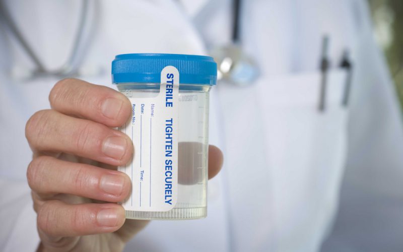 Как определить дипилидиоз