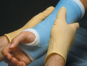 Пластиковый гипс Гипс при переломе шиловидного отростка