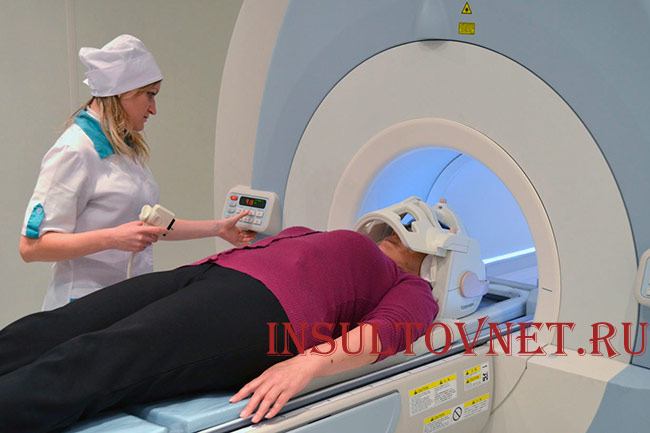 МРТ головного мозга