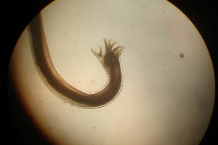 анкилостома