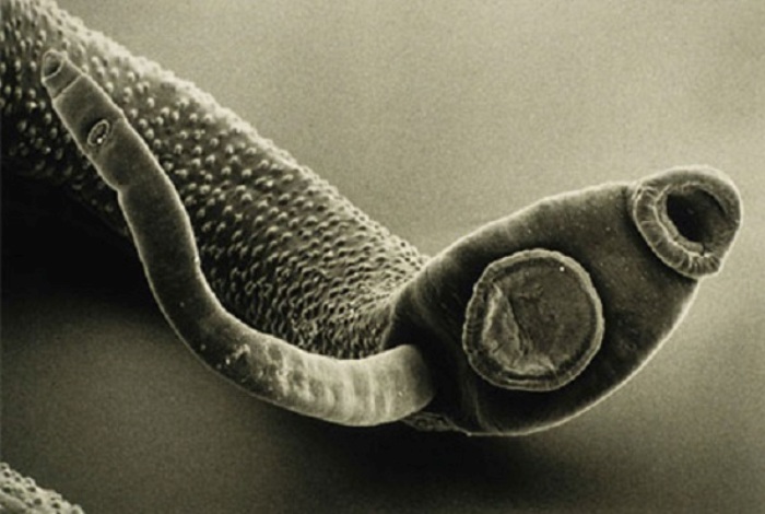 что такое острицы