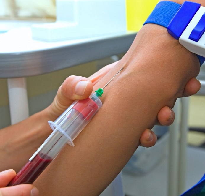 Забор венозной крови для исследования на токсокароз