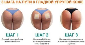 Эффективность перцового пластыря от целлюлита