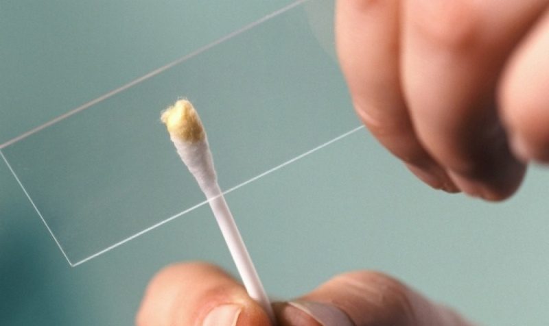 Соскоб на глисты