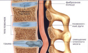 Почему происходит боль в спине и позвоночнике