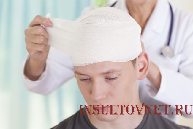 Сотрясение головного мозга