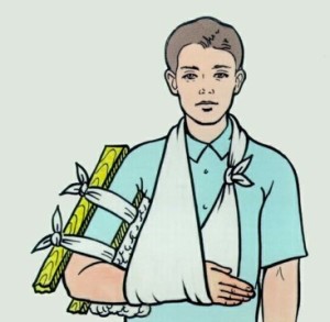 Перелом плечевой кости Как оказать первую поморщь пострадавшему с переломом плечевой кости