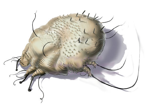 как лечить чесотку